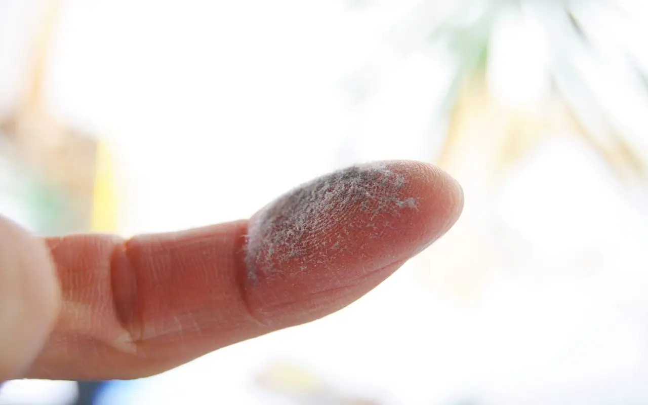 Attenzione agli acari della polvere: come riconoscerli e agire subito in casa Attenzione agli acari della polvere: come riconoscerli e agire subito in casa