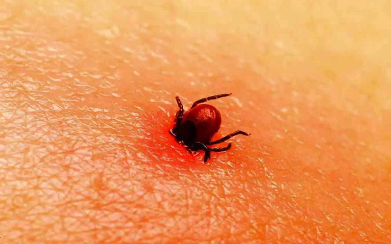 Acari sulla pelle: come riconoscere i segnali e prevenire i rischi per la salute Acari sulla pelle: come riconoscere i segnali e prevenire i rischi per la salute