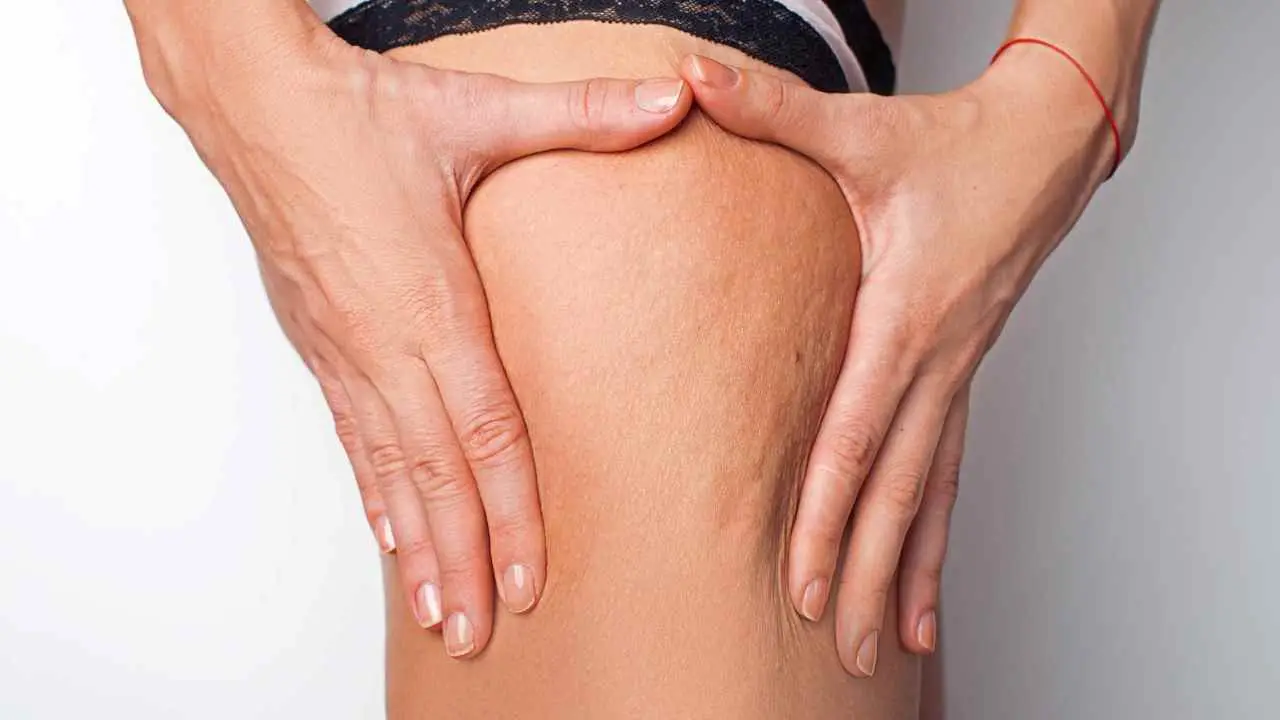 Capillari fragili o rotti su gambe e viso? Ecco cosa succede davvero al tuo corpo